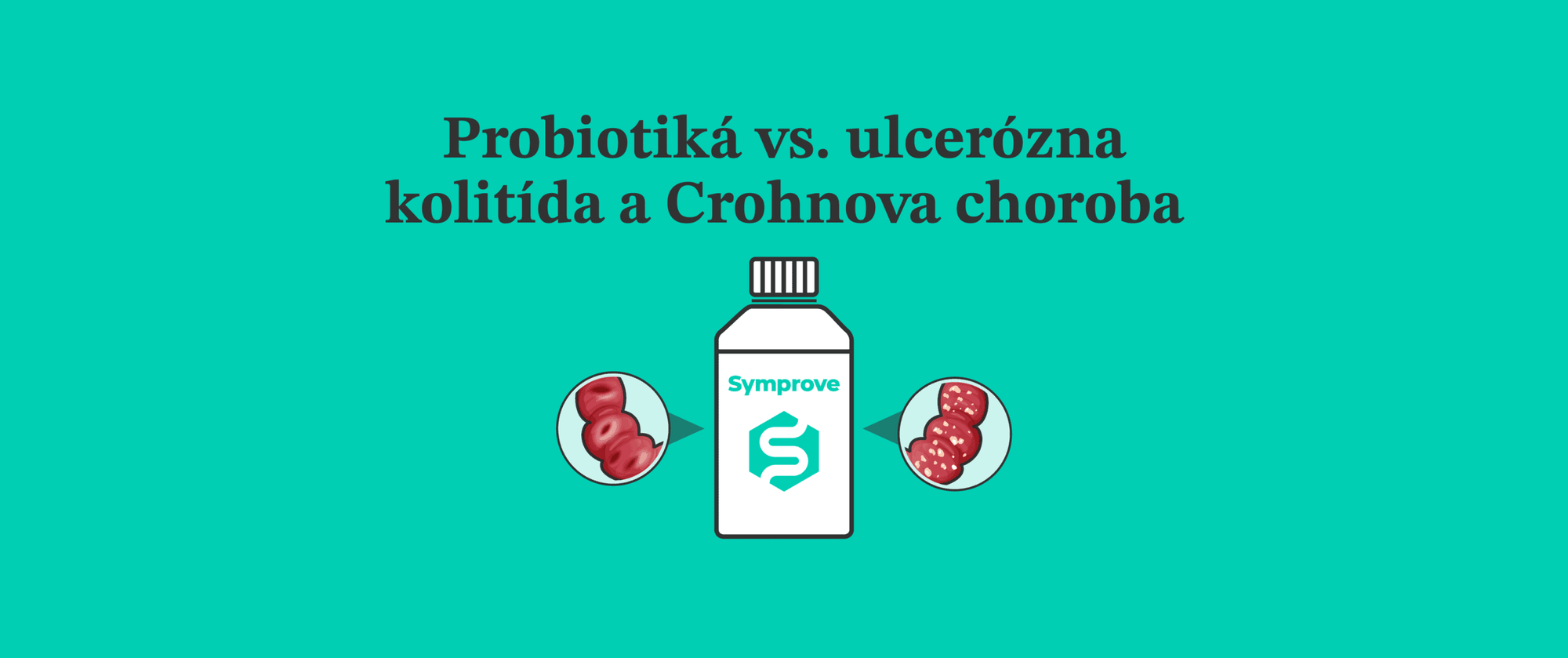 Probiotiká vs. ulcerózna kolitída a Crohnova choroba